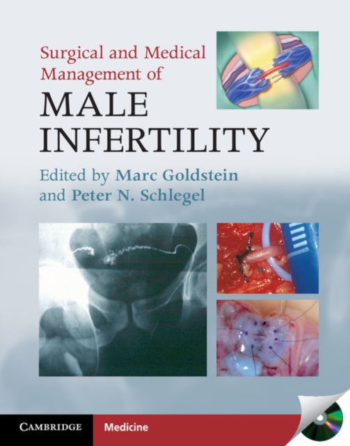 Book cover of: Surgical and Medical Management of Male Infertility. By: Marc Goldstein