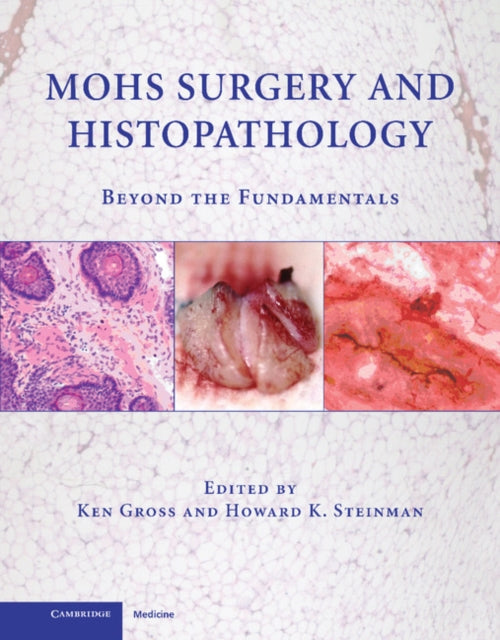 Book cover of: Mohs Surgery and Histopathology