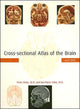 Book cover of: Cross-sectional Atlas of the Brain and DVD. By: Peter Ratiu