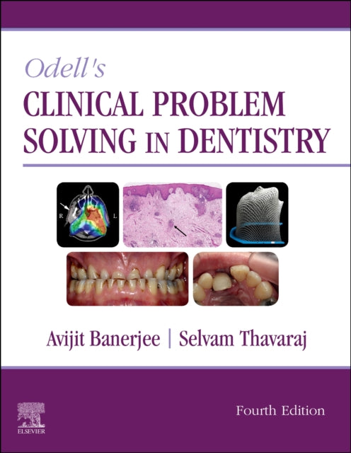 Book cover of: Odell's Clinical Problem Solving in Dentistry. By: Avijit Banerjee BDS MSc PhD (Lond) LDS FDS (Rest Dent) FDS RCS (Eng) FHEA