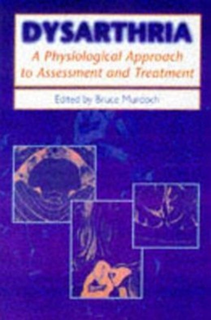 Book cover of: DYSARTHRIA. By: Bruce Murdoch