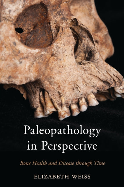 Book cover of: Paleopathology in Perspective. By: Elizabeth Weiss