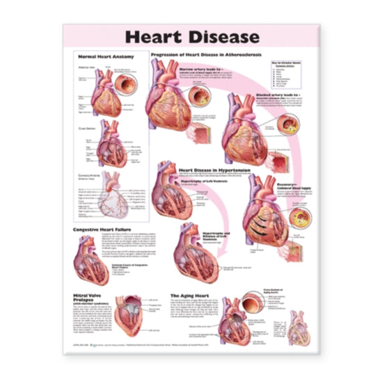 Book cover of: Heart Disease Anatomical Chart