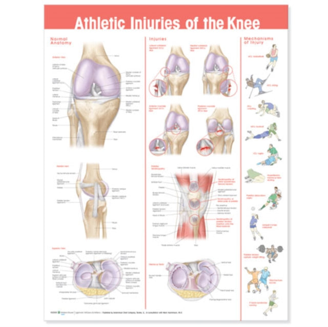 Book cover of: Athletic Injuries of the Knee Anatomical Chart