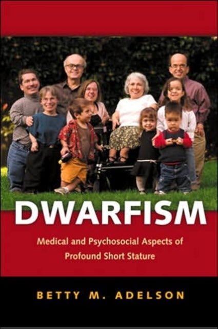 Book cover of: Dwarfism. By: Betty M. Adelson