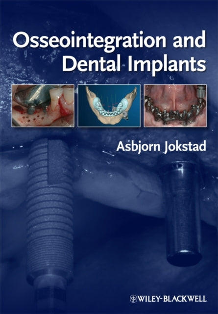 Book cover of: Osseointegration and Dental Implants. By: Toronto Osseointegration Conference Revisited (2008 Toronto, Canada)