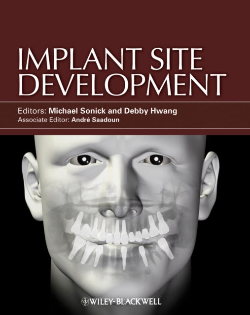 Book cover of: Implant Site Development. By: Michael Sonick