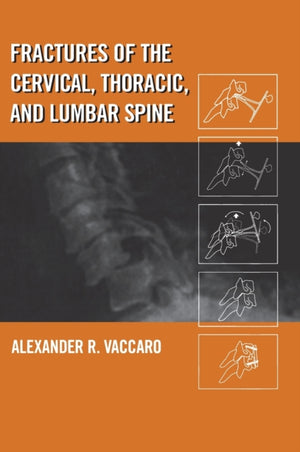 Fractures of the Cervical, Thoracic, and Lumbar Spine