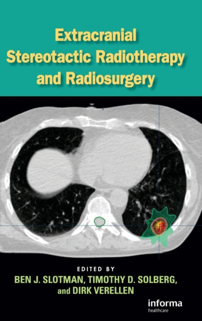 Book cover of: Extracranial Stereotactic Radiotherapy and Radiosurgery