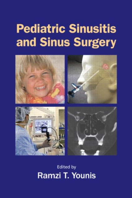 Book cover of: Pediatric Sinusitis and Sinus Surgery. By: Ramzi T. Younis