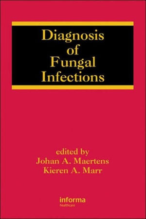 Diagnosis of Fungal Infections