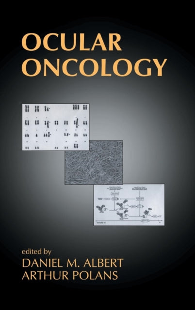 Book cover of: Ocular Oncology