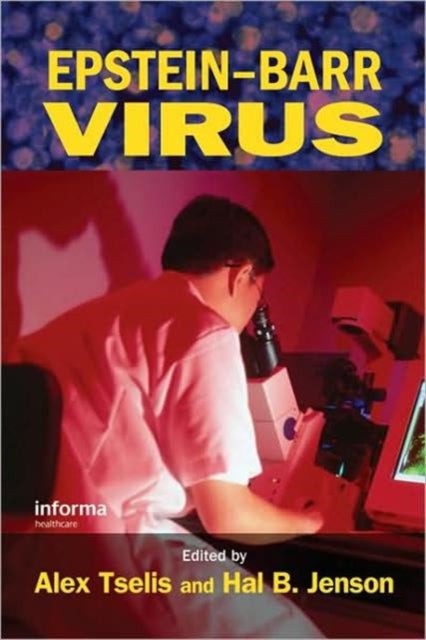 Book cover of: Epstein-Barr Virus