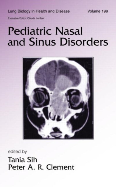 Book cover of: Pediatric Nasal and Sinus Disorders