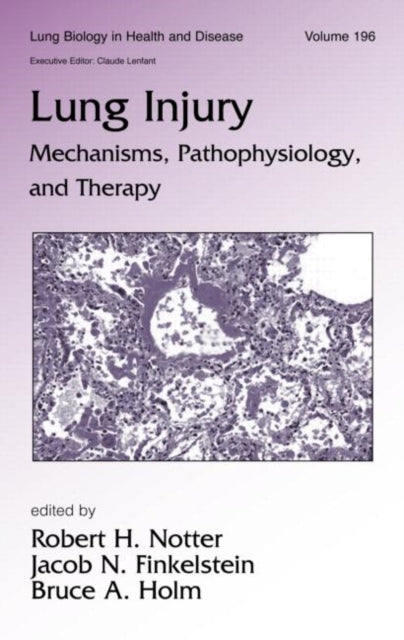Book cover of: Lung Injury