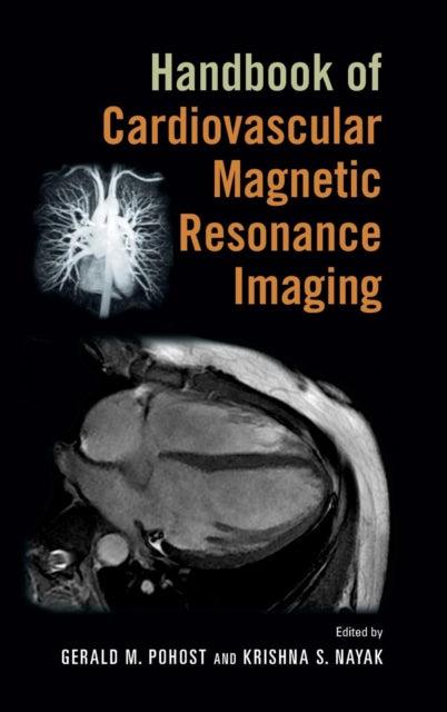 Book cover of: Handbook of Cardiovascular Magnetic Resonance Imaging