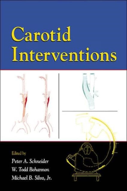 Book cover of: Carotid Interventions