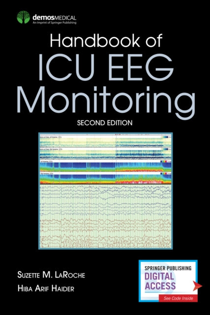 Book cover of: Handbook of ICU EEG Monitoring. By: Suzette LaRoche