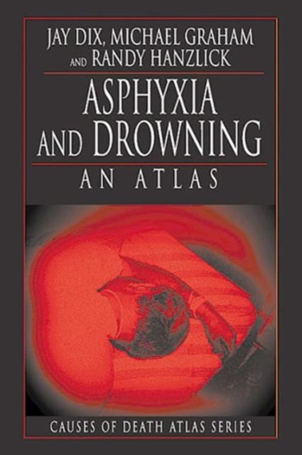 Book cover of: Asphyxia and Drowning. By: Jay Dix