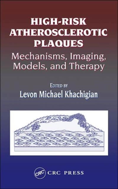 Book cover of: High-Risk Atherosclerotic Plaques. By: Levon Michael Khachigian