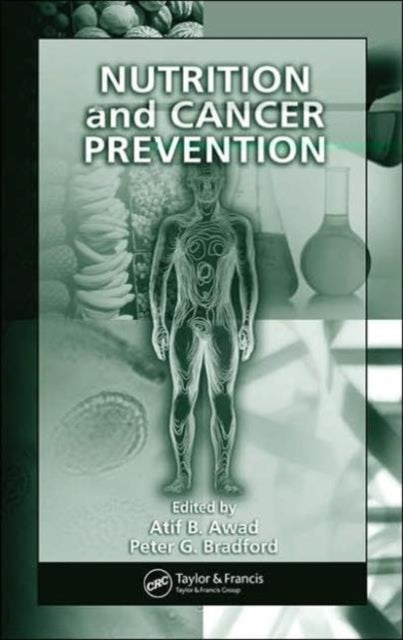 Book cover of: Nutrition and Cancer Prevention