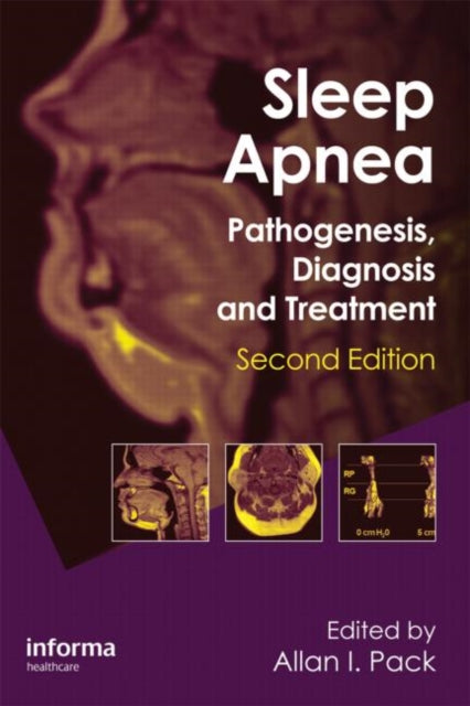 Book cover of: Sleep Apnea. By: Allan I. Pack