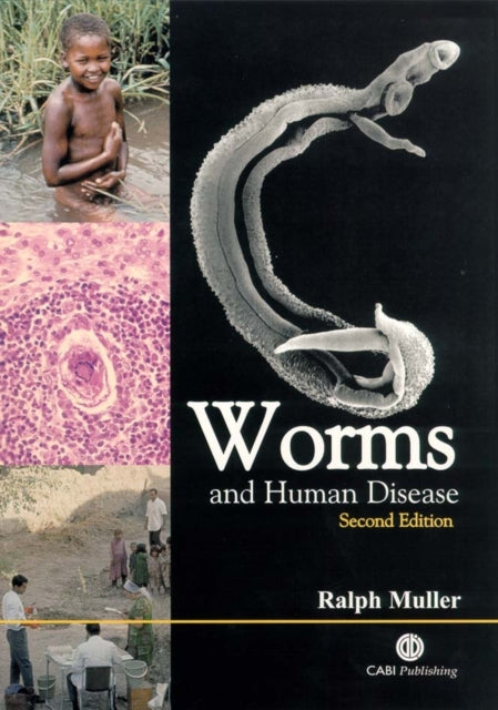 Book cover of: Worms and Human Disease. By: R. Muller