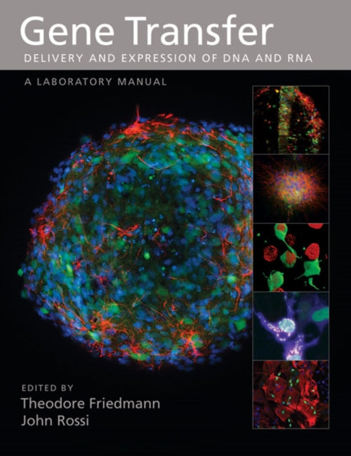 Book cover of: Gene Transfer