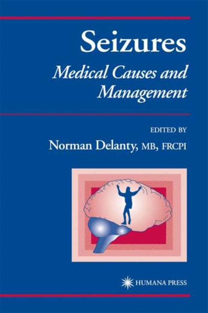 Book cover of: Seizures. By: Norman Delanty