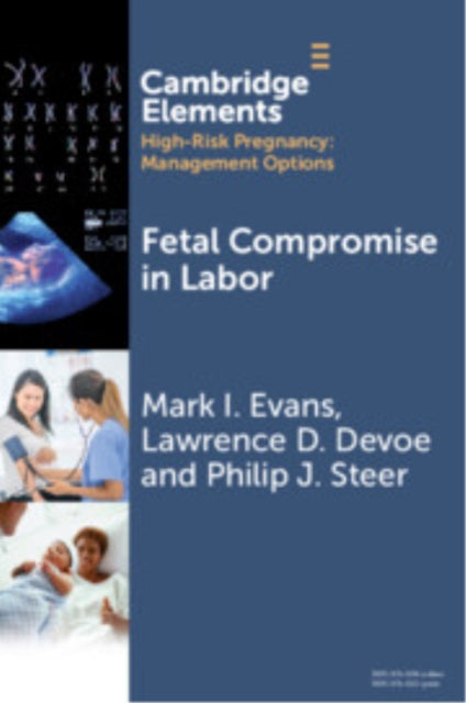 Book cover of: Fetal Compromise in Labor. By: Mark I. Evans