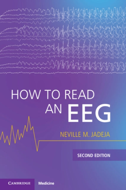 Book cover of: How to Read an EEG