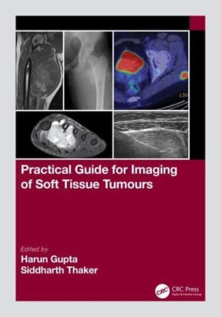 Book cover of: Practical Guide for Imaging of Soft Tissue Tumours. By: Harun Gupta