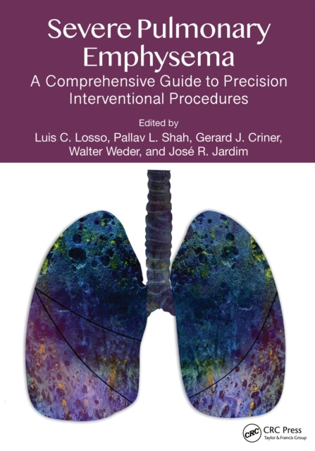 Book cover of: Severe Pulmonary Emphysema: