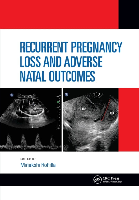 Book cover of: Recurrent Pregnancy Loss and Adverse Natal Outcomes. By: Minakshi Rohilla