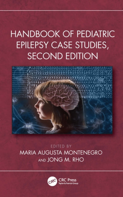 Book cover of: Handbook of Pediatric Epilepsy Case Studies, Second Edition. By: Jong M. Rho