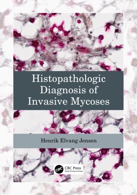 Book cover of: Histopathologic Diagnosis of Invasive Mycoses. By: Henrik Elvang Jensen