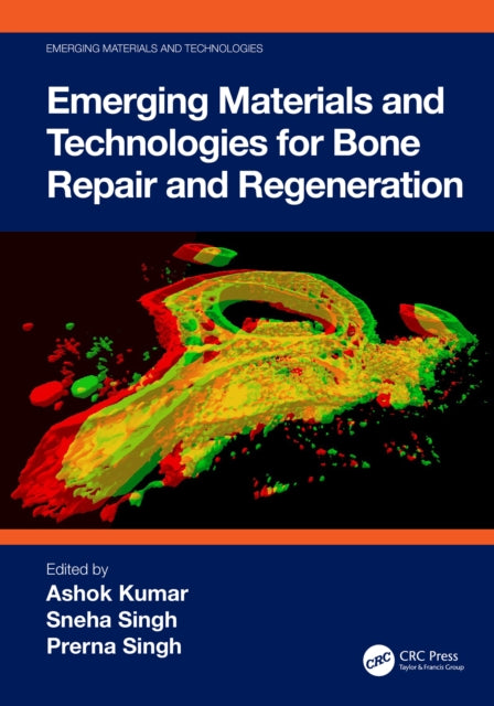 Book cover of: Emerging Materials and Technologies for Bone Repair and Regeneration. By: Ashok Kumar