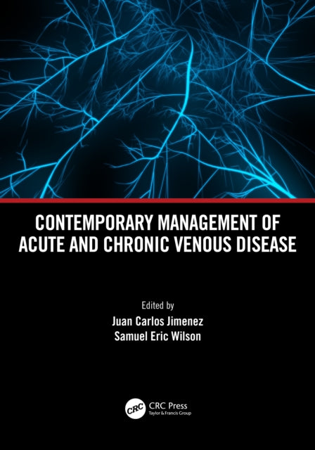 Book cover of: Contemporary Management of Acute and Chronic Venous Disease