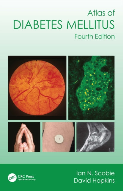 Book cover of: Atlas of Diabetes Mellitus. By: Ian N. Scobie