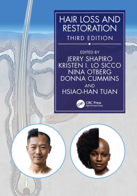 Book cover of: Hair Loss and Restoration. By: Jerry Shapiro