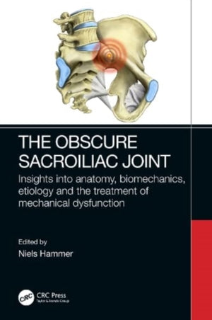 Obscure Sacroiliac Joint
