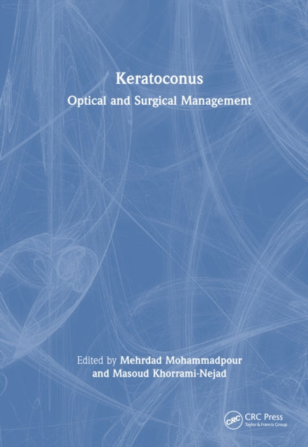 Book cover of: Keratoconus