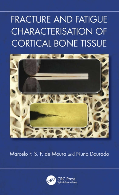 Book cover of: Fracture and Fatigue Characterisation of Cortical Bone Tissue. By: Marcelo F. S. F. de Moura