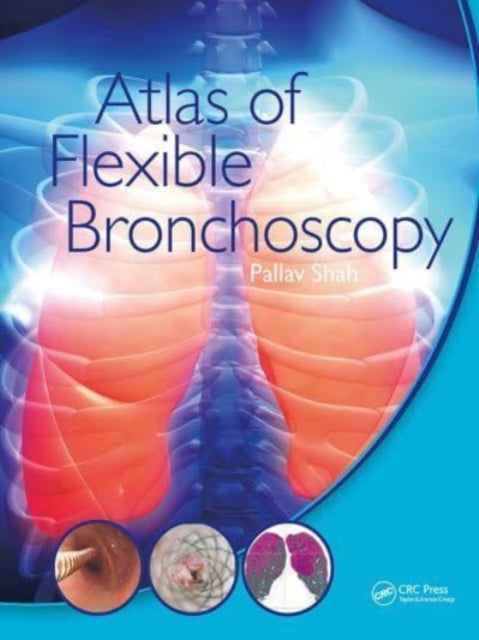 Book cover of: Atlas of Flexible Bronchoscopy. By: Pallav Shah