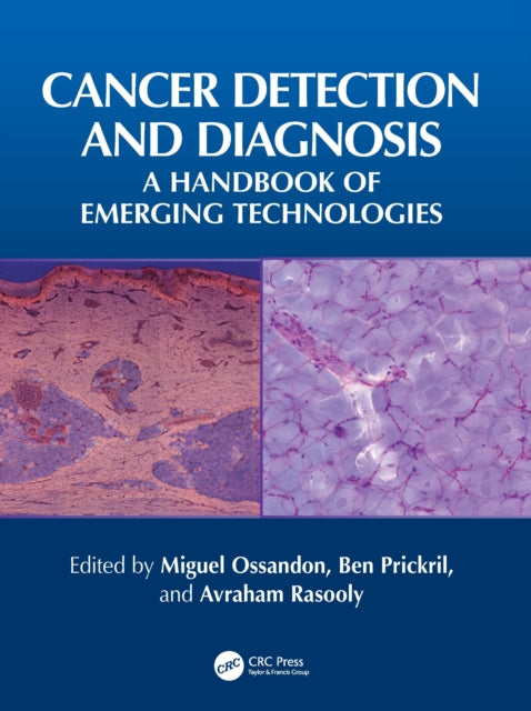 Book cover of: Cancer Detection and Diagnosis