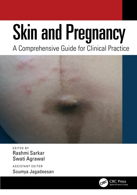Book cover of: Skin and Pregnancy
