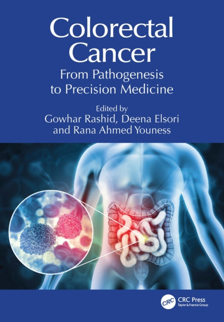 Book cover of: Colorectal Cancer. By: Gowhar Rashid