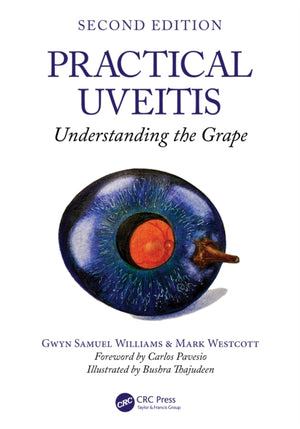 Practical Uveitis