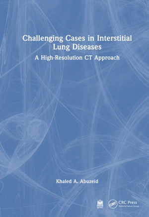 Challenging Cases in Interstitial Lung Diseases
