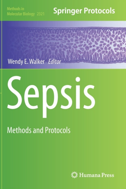 Book cover of: Sepsis. By: Wendy E. Walker